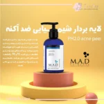پیلینگ شیمیایی اسیدتراپی آکنه