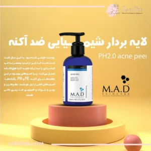 پیلینگ شیمیایی اسیدتراپی آکنه